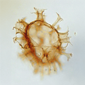 Heterosphaeridium difficile PetroStrat