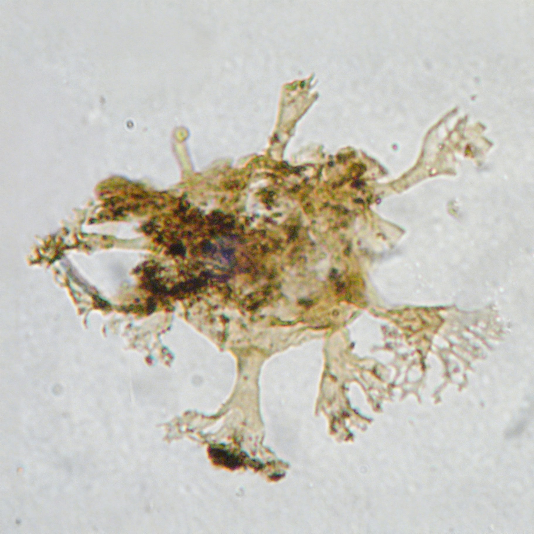 Oligosphaeridium patulum PetroStrat